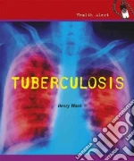 Tuberculosis libro in lingua di Wouk Henry