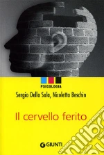 Della Sala Sergio; Beschin Nicoletta