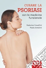 Cavallini Federica; Antolini Paolo