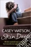 Watson Casey