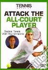 Annacone Paul